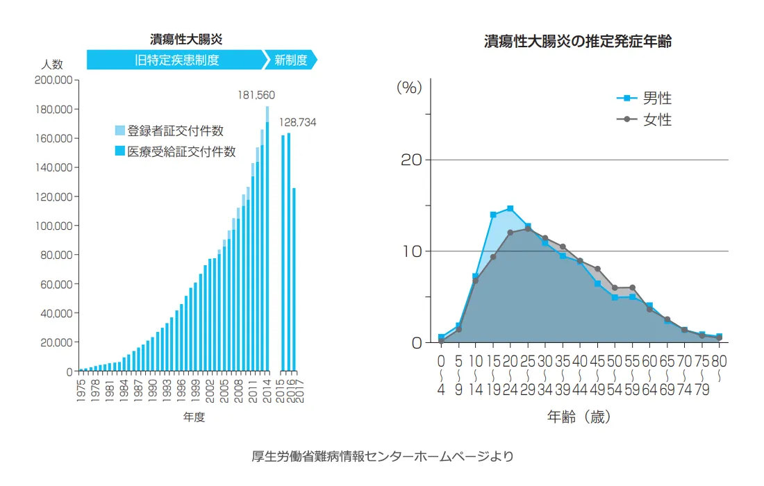 潰瘍性大腸炎、推定発症年齢