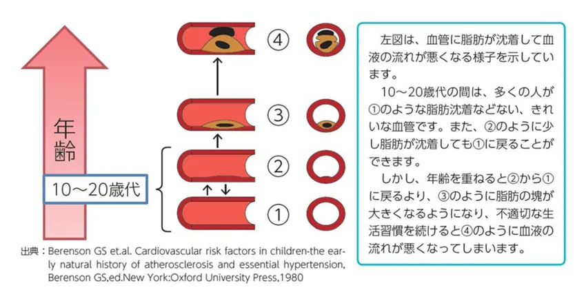 動脈硬化